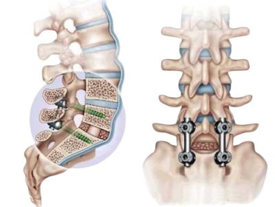 Боли в спине: причины, диагностика, лечение и профилактика
